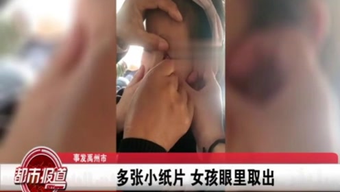 吓人!7岁小姑娘的眼睛里被同学塞了很多小纸片,医生不断取出!